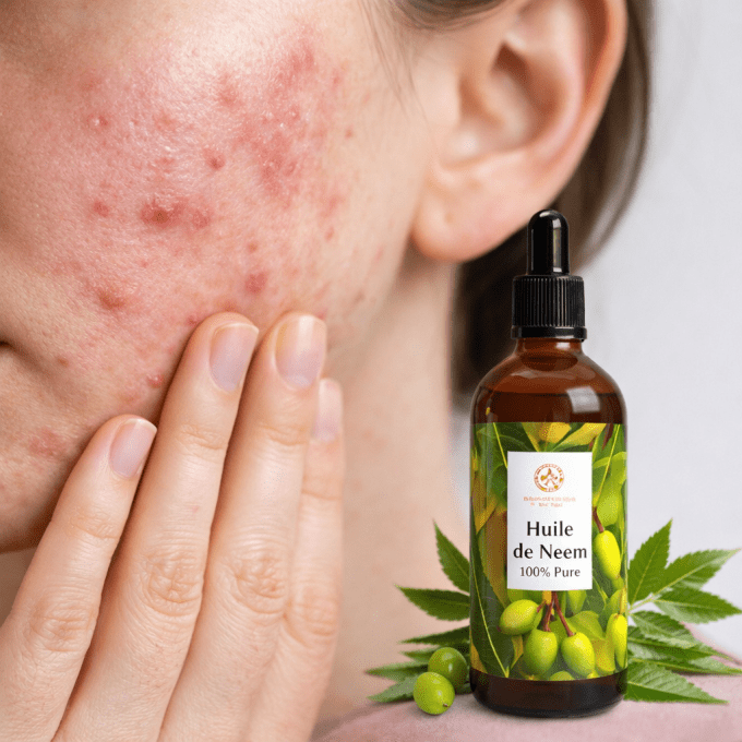 Huile De Neem 100% Pure - 100ml